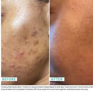 🆕️💚 ✨️Urban Skin Even Tone Smooth & Glow Enzyme Mask ✨️💚